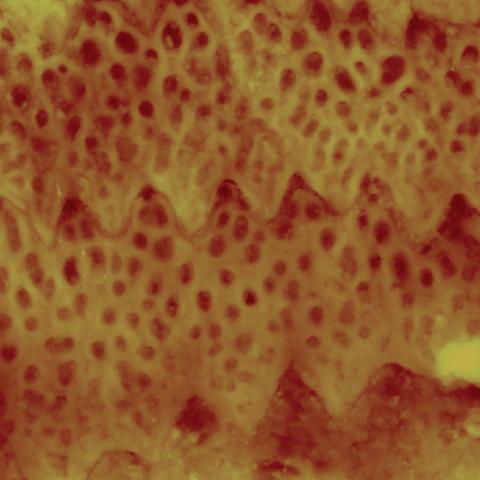 Sidewinder snake microstructures