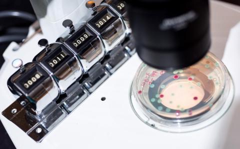 Colonies of competing bacteria